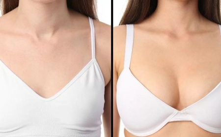 Revision Surgery Options from the Best Breast Augmentation Surgeons in Dubai