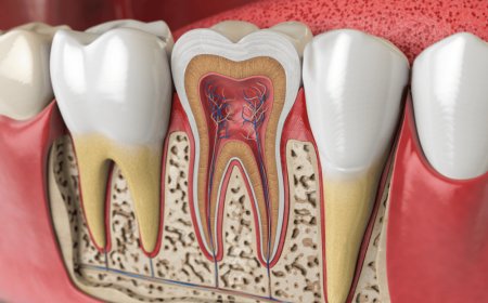 Understanding Root Canal Therapy in Grande Prairie: What You Need to Know