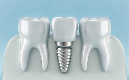 Helping You Maintain a Beautiful Smile in Dewsbury