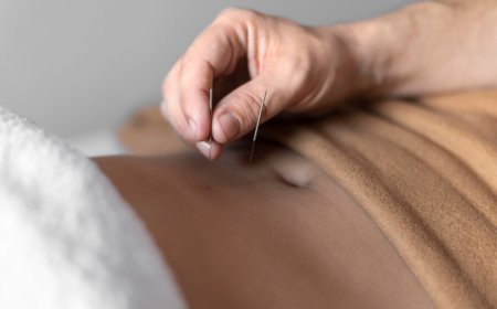 Understanding Acupuncture: How It Works and What to Expect at Our Phoenix Clinic